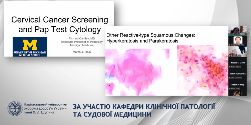 Міжнародна лекція об’єднала українських лікарів для обговорення цитологічного скринінгу 