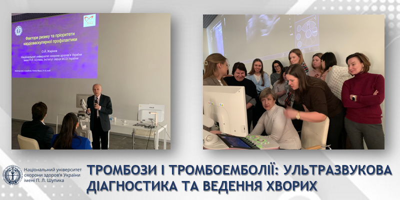 Майстер-клас із судинного ультразвукового дослідження